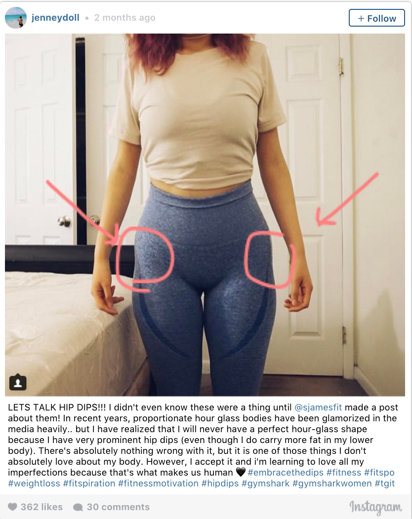 Curvy Without Surgery, Hacks for Hiding Hip Dips, FUPA, Saddle Bags